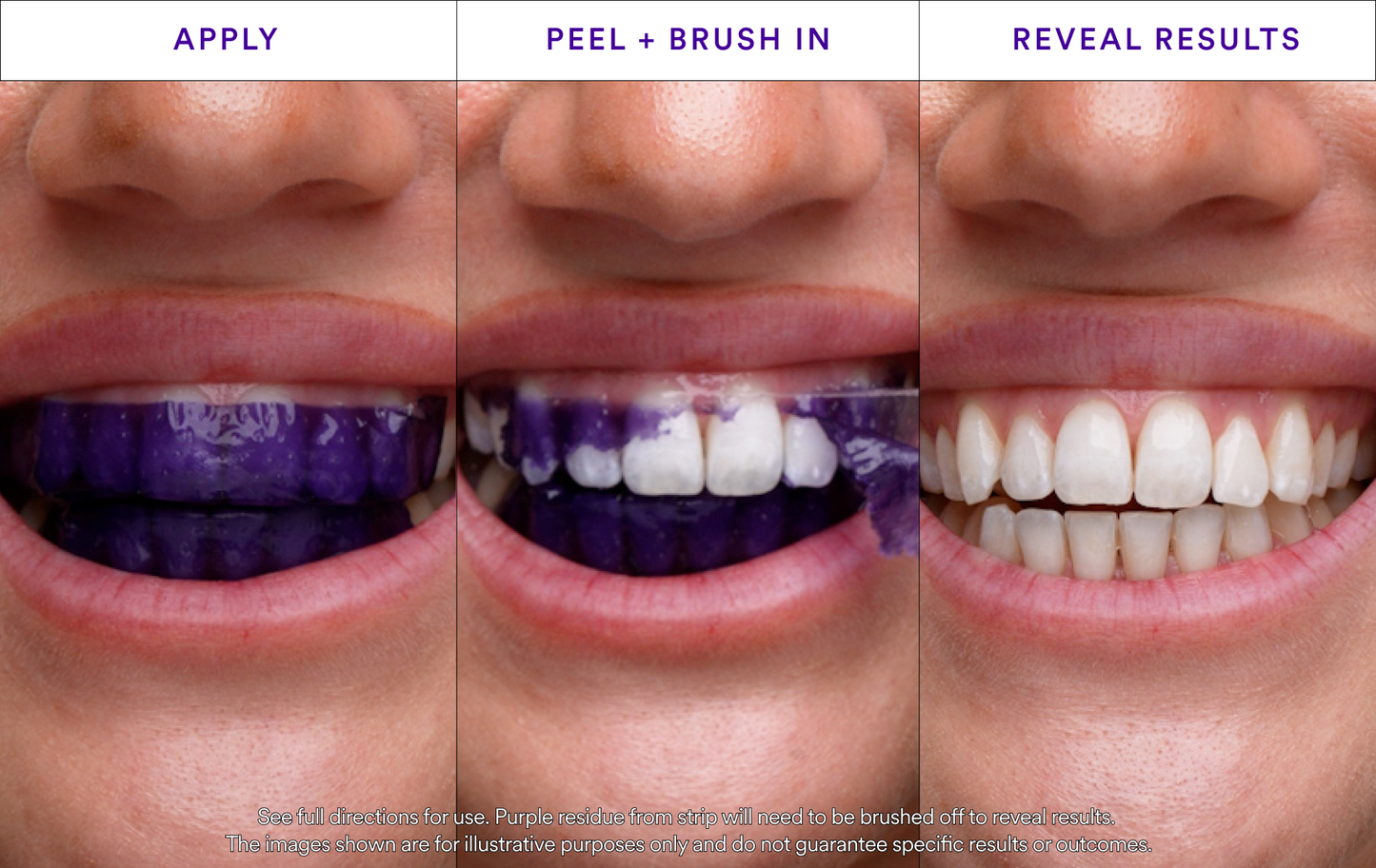 NESLEMY™ Whitening Strips