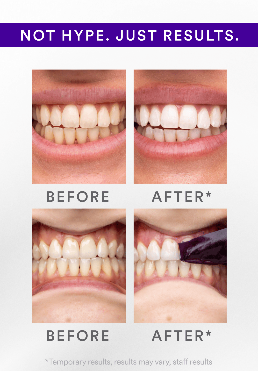 NESLEMY™ Whitening Strips