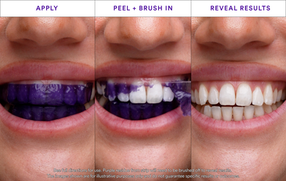 NESLEMY™ Whitening Strips